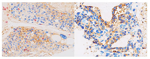 Biocare Medical Anticorps monoclonal P40 Clone BC28